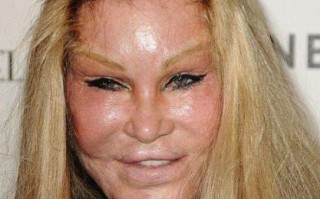 因整容而毁容吓人的明星，因整容而毁容吓人的明星有哪些